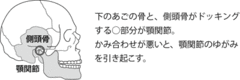 「いい人」ほど骨がゆがみやすい