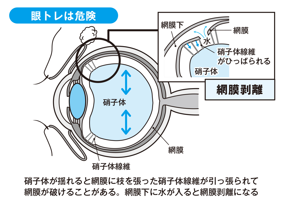 眼トレは危険