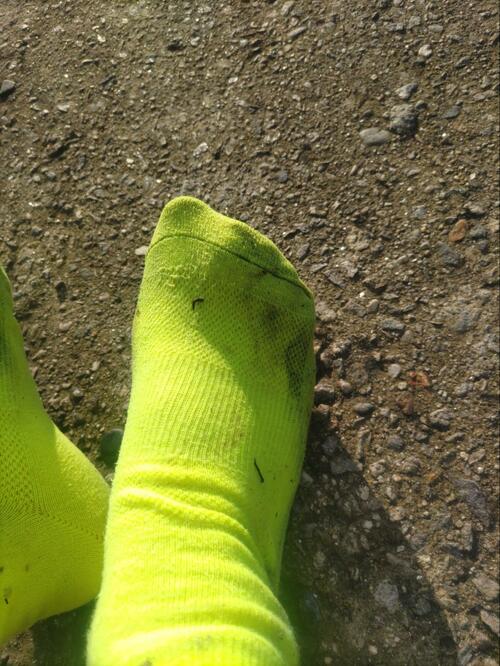 ヒルの襲撃で足がパンパンに腫れ上がってしまった（提供=筆者）