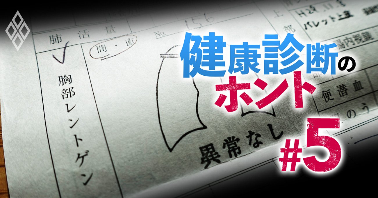 肺がん検診で見落とし続出 ガラパゴス な実態とその理由 健康診断のホント ダイヤモンド オンライン