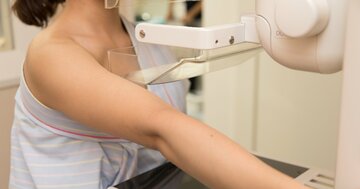 乳がんだけじゃない？マンモグラフィで早期発見できる「重大な健康リスク」とは【12.5万人のデータを検証】