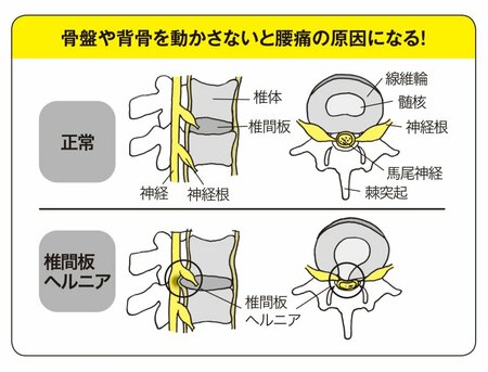 【『世界一受けたい授業』で話題】つらい腰痛持ちの人は絶対やってみて！フィジカルトレーナー・中野ジェームズ修一が教える慢性的な腰痛を予防・解消する方法