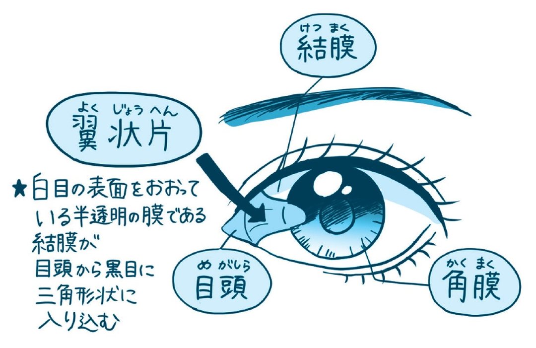 放っておくと怖い目の症状 スキーに行ったら翌日 目が開かなくなった ハーバード スタンフォードの眼科医が教える 放っておくと怖い目の症状25 ダイヤモンド オンライン