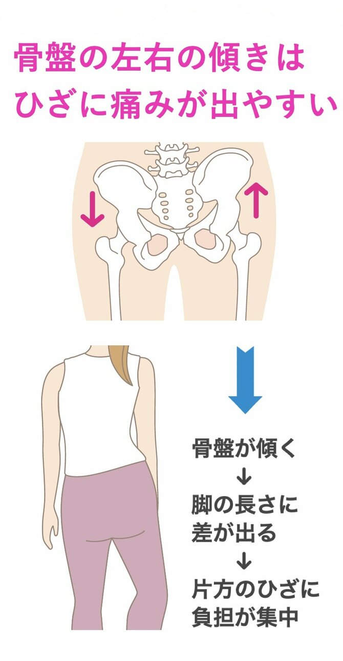 【整体プロが指南】「歩く」「走る」前後に取り入れてみて。ひざの不安が軽くなる習慣