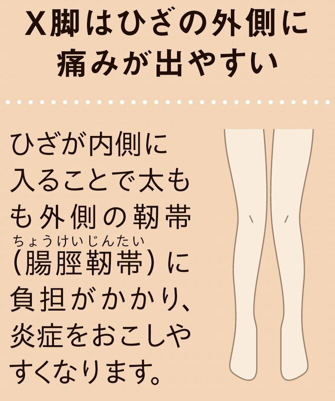【整体プロが指南】「歩く」「走る」前後に取り入れてみて。ひざの不安が軽くなる習慣