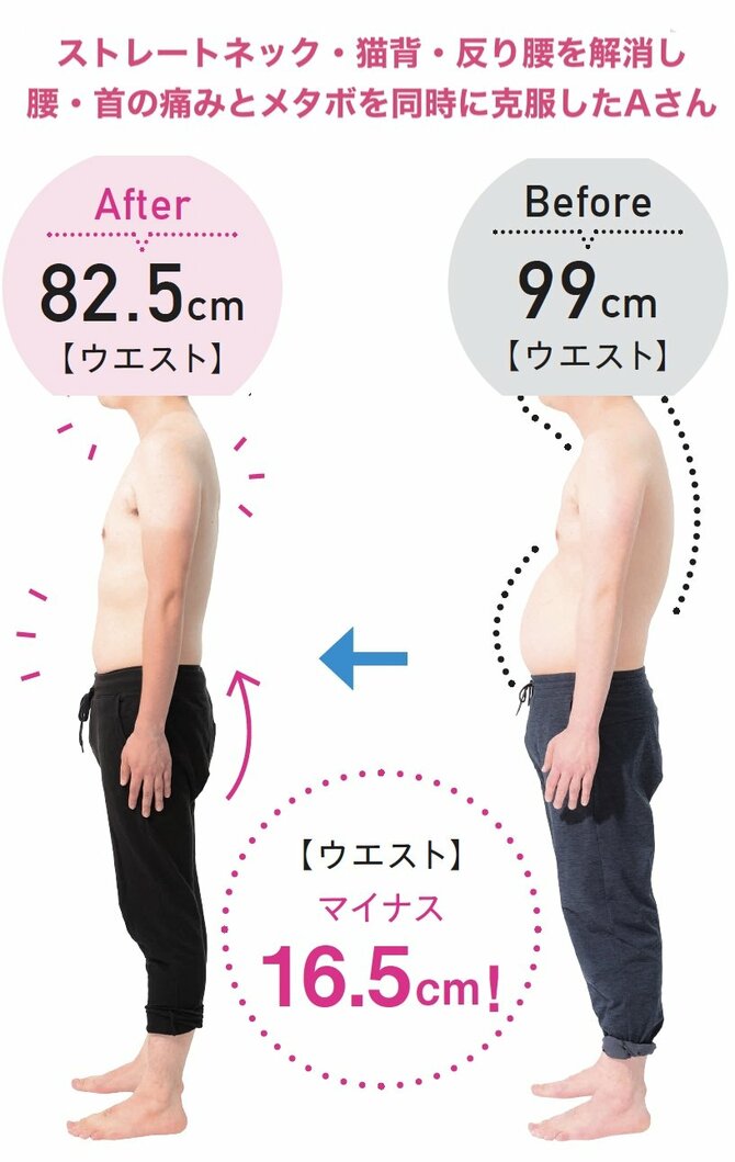 見た目でわかる!? 「通院しても腰痛がなおりにくい人」の共通点【自分でできる整体のススメ】