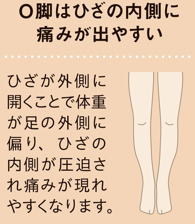 【整体プロが指南】「歩く」「走る」前後に取り入れてみて。ひざの不安が軽くなる習慣