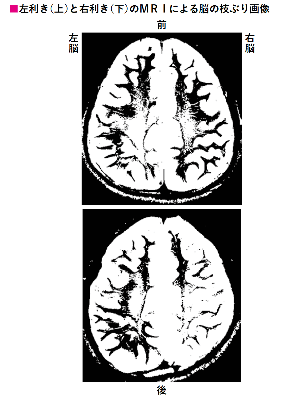 左利きと右利きの発想 脳内科医が明らかにする決定的な違い すごい左利き ダイヤモンド オンライン