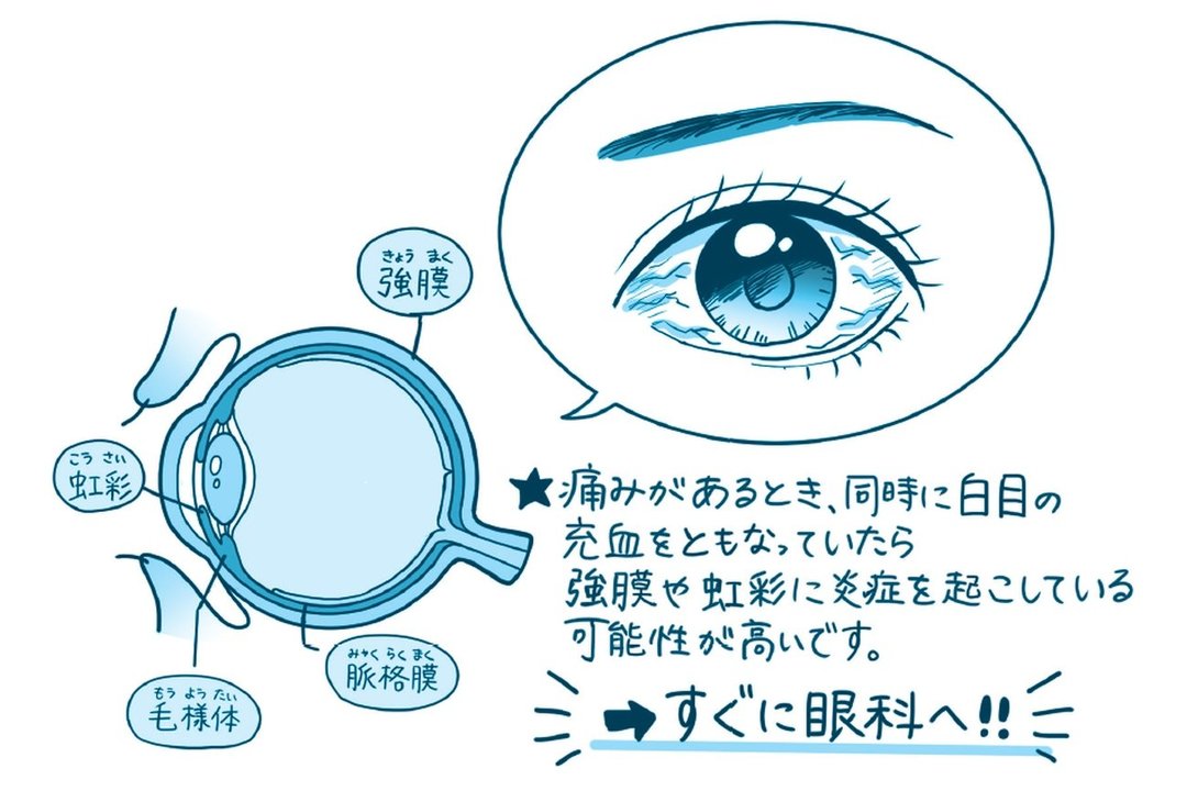 放っておくと怖い目の症状 目が痛い のは 目の中 まぶたのどっちが痛いのか ハーバード スタンフォードの眼科医が教える 放っておくと怖い目の症状25 ダイヤモンド オンライン