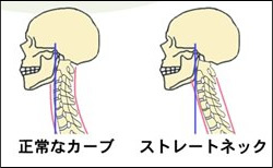 “ながら歩き”や“ストレートネック”に要注意!<br />今後増加しそうな「スマホ注意喚起キャンペーン」