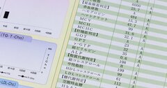 人間ドックの「お金はかかるが、あまり意味がない検査」の超意外な共通点