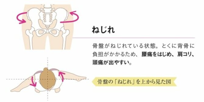 【整体プロが指南】腰痛が出やすい人の「2つの特徴」とは？ 早めに鍛えておきたい場所