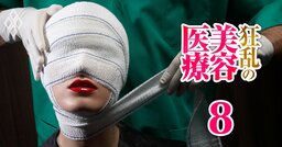 美容医療で死亡・HIV感染・無免許手術…17兆円市場で「安全」が置き去りに！世界各国で後手に回る「規制」の実態、日本は？