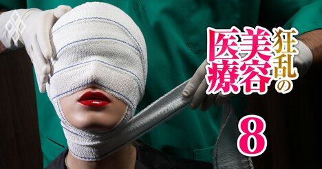 美容医療で死亡・HIV感染・無免許手術…17兆円市場で「安全」が置き去りに！世界各国で後手に回る「規制」の実態、日本は？