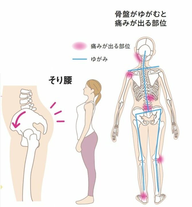 【整体プロが指南】腰痛が出やすい人は「立ち姿」でわかる？ 早めに整えておきたい場所とは？